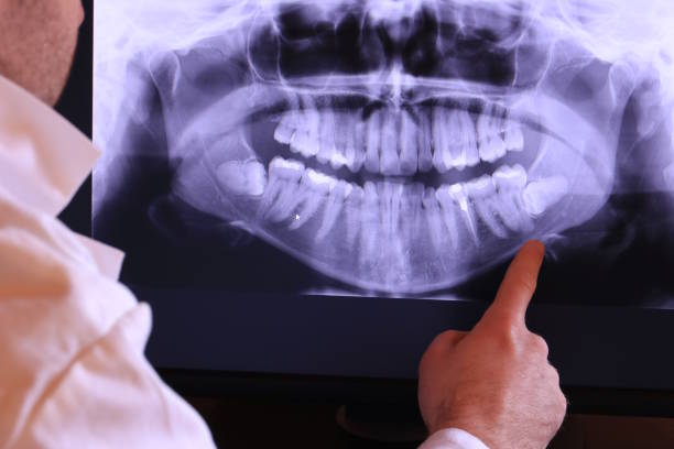 Best After-Hours Emergency Dentist in Fairland, OK
