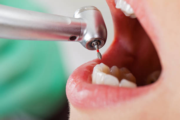 Best Emergency Dental Care for Trauma or Injury in Fairland, OK